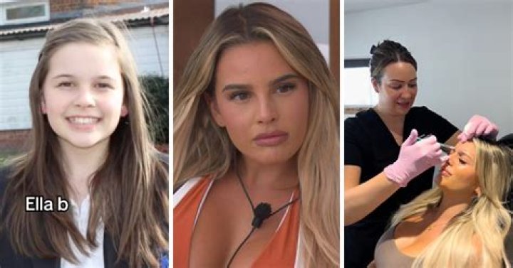 Ella B Love Island Before Surgery