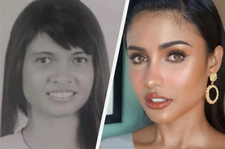 Rabiya Mateo Plastic Surgery before and after