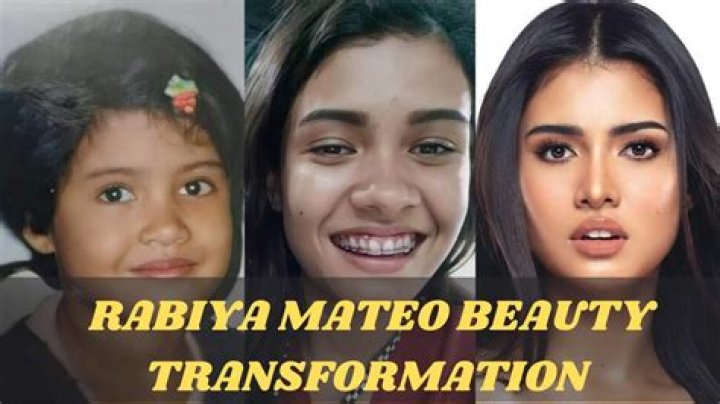 Rabiya Mateo plastic surgery