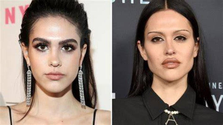These Celebrities Are Unrecognizable After Plastic Surgery